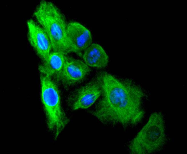 Anti-Vimentin Antibody (3N67)
