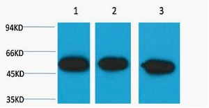 Anti-TUBB3 Antibody (2J22)
