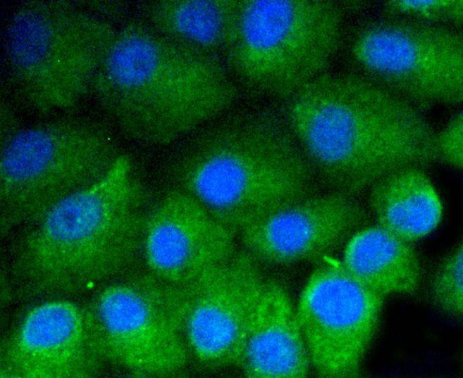 Anti-Vitronectin Antibody (8C403)