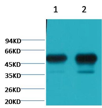 Anti-TUBB2A Antibody (5L160)