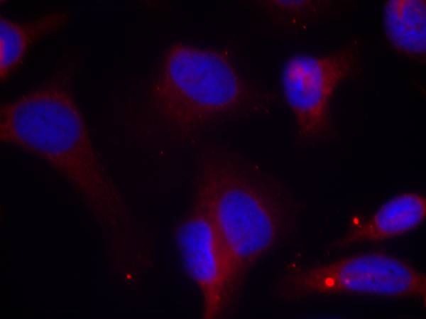 Anti-Phospho-ZAP70 (Tyr319) Polyclonal Antibody