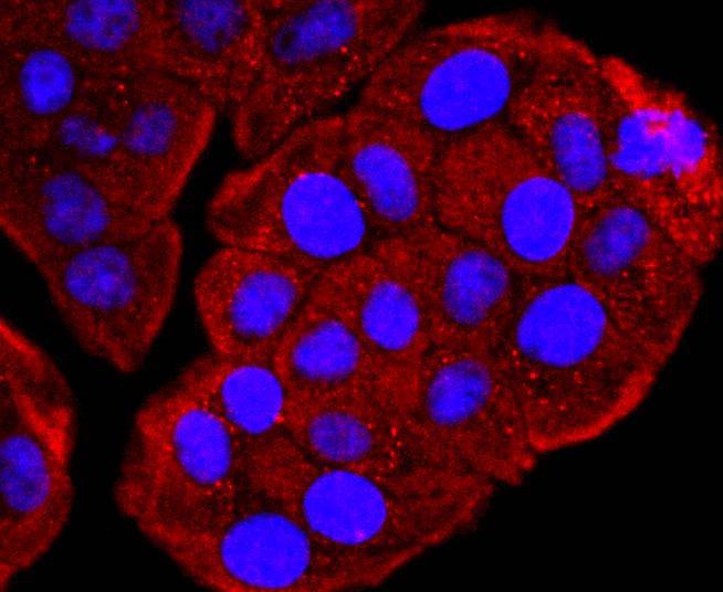 Anti-VDB Antibody (2T657)