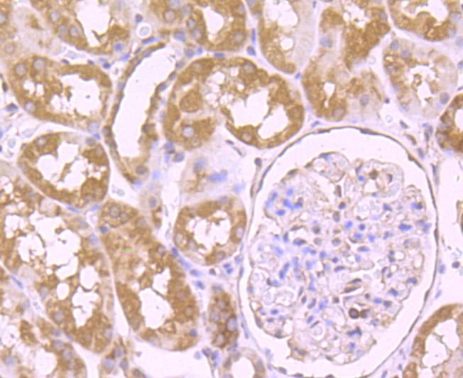 Anti-VPS35 Antibody (7F247)