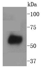 Anti-WASF2 Antibody (1E220)