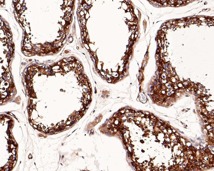 Anti-Vinculin Antibody (3Q495)