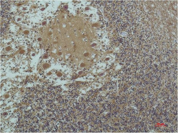 Anti-Acetyl-α-tubulin (Lys40) Antibody (7S611)