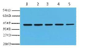 Anti-Beta-Actin Antibody (5H32)