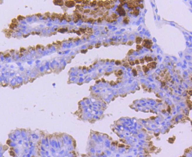Anti-WASF2 Antibody (1E220)