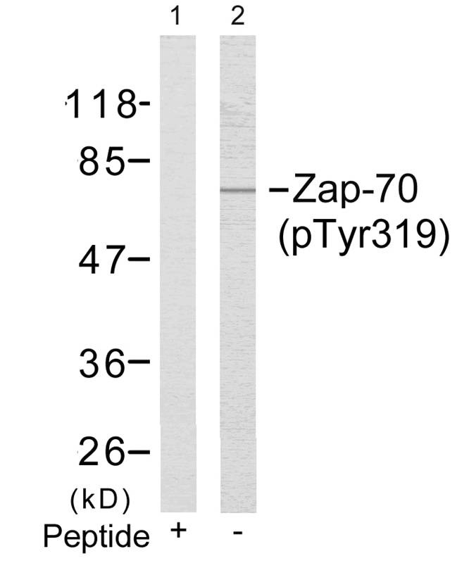 Anti-Phospho-ZAP70 (Tyr319) Polyclonal Antibody