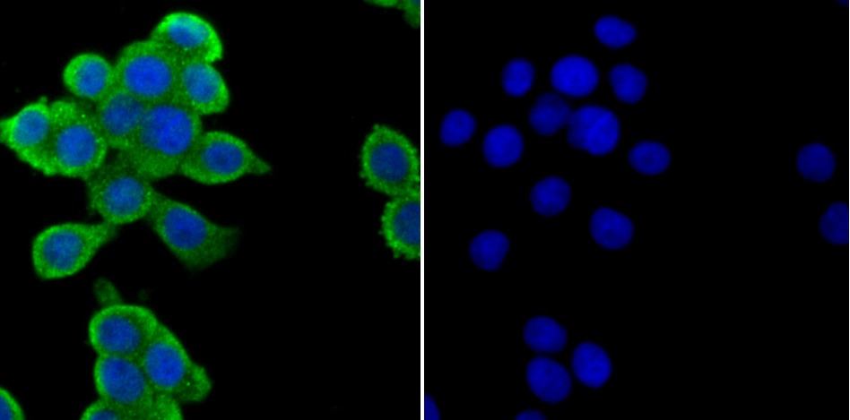 Anti-ZAP70 Antibody (2J161)