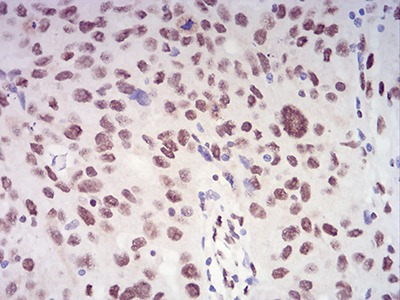Anti-XRN2 Antibody (1B629)