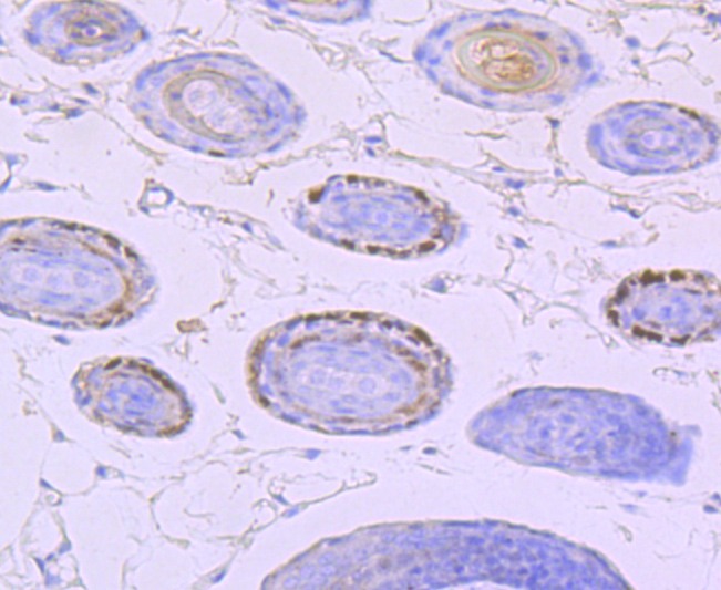 Anti-Vitamin D Receptor/VDR Antibody (5D259)