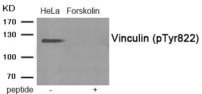 Anti-Phospho-Vinculin (Tyr822) Polyclonal Antibody