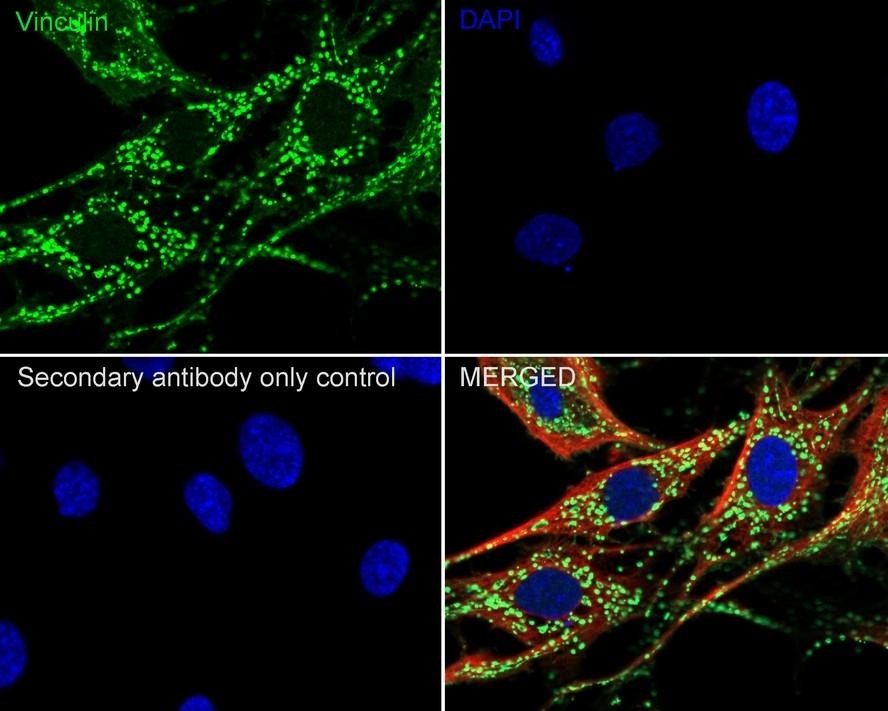 Anti-Vinculin Antibody (3Q495)