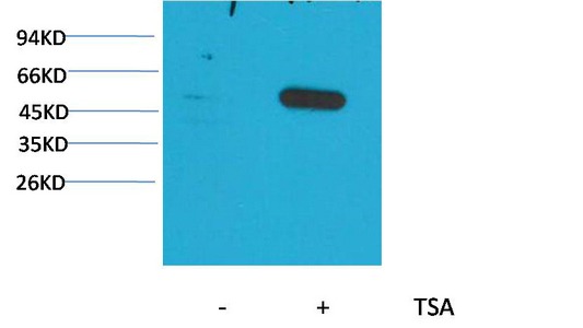 Anti-Acetyl-α-tubulin (Lys40) Antibody (7S611)