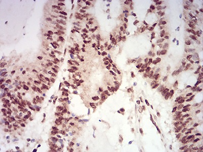 Anti-XRN2 Antibody (1B629)