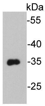 Anti-VSV-G Tag Antibody (2P547)