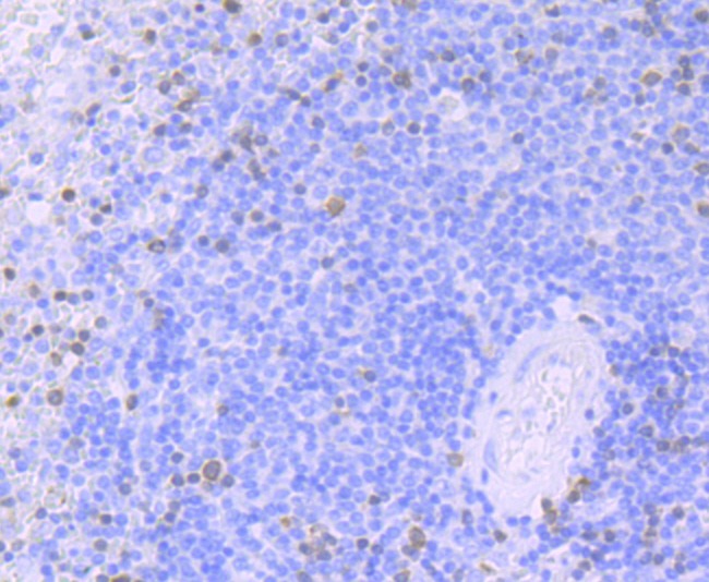 Anti-ZAP70 Antibody (2J161)