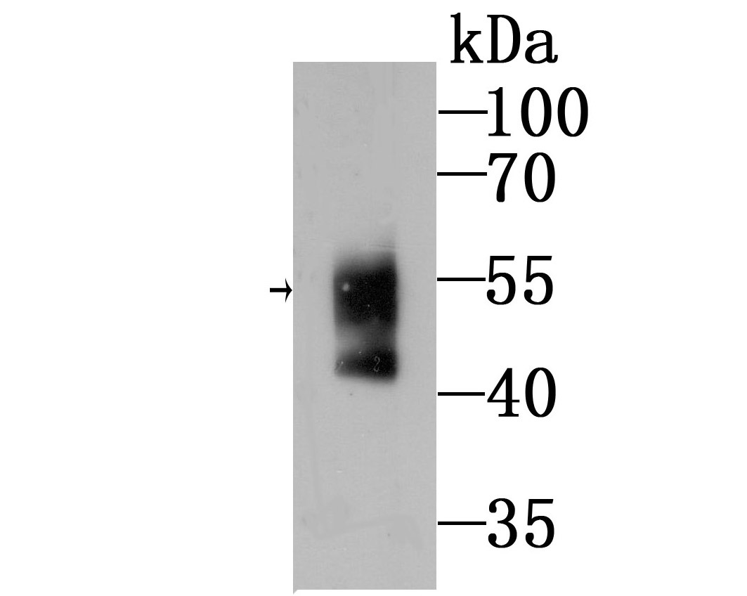 Anti-WASL Antibody (8M531)
