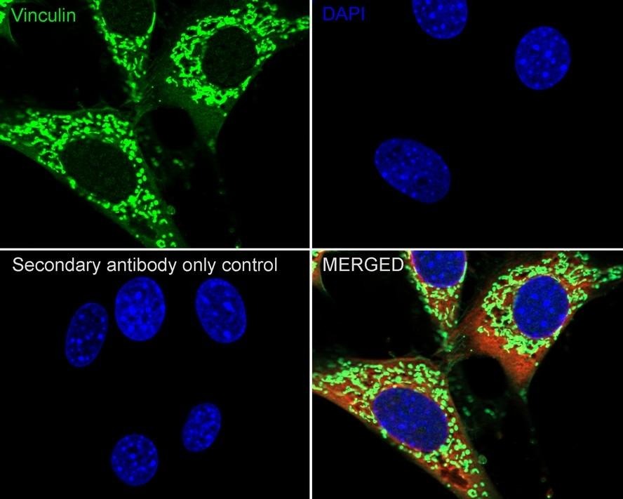 Anti-Vinculin Antibody (3Q495)