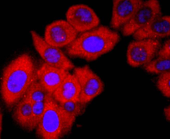 Anti-VDB Antibody (2T657)