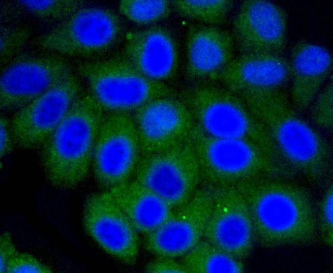 Anti-Vitronectin Antibody (8C403)