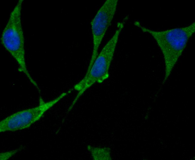 Anti-WASL Antibody (8M531)