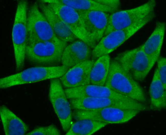 Anti-Wnt2b Antibody (5C251)