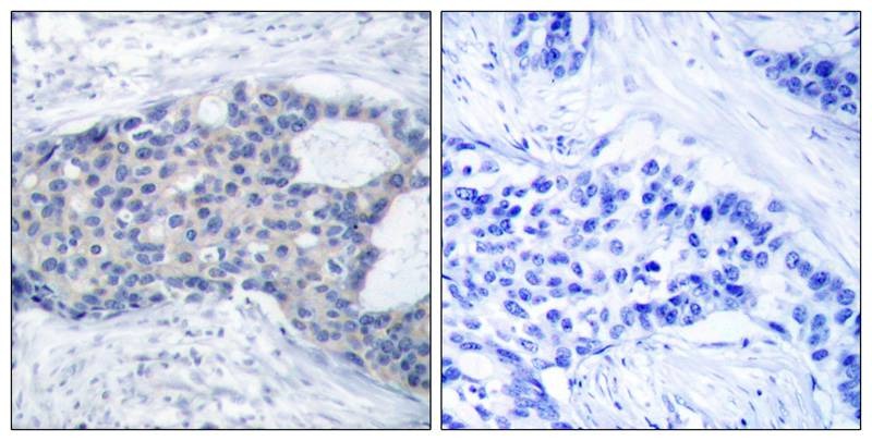 Anti-Phospho-ZAP70 (Tyr493) Polyclonal Antibody