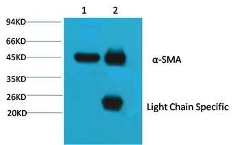 Anti-ACTA1 Antibody (8I400)