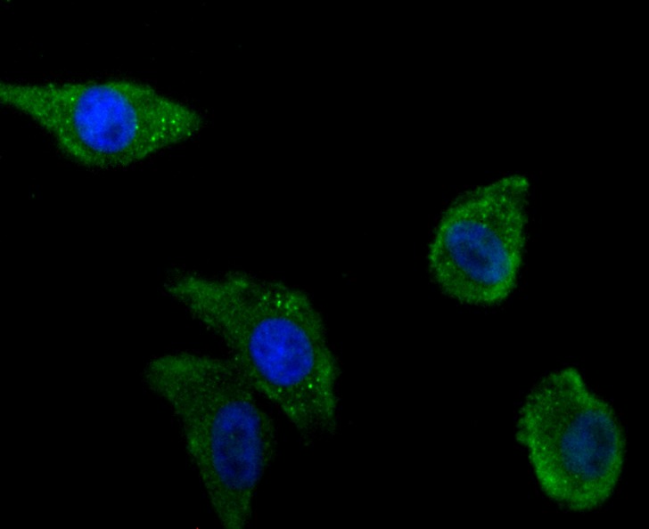 Anti-Zyxin Antibody (5W666)