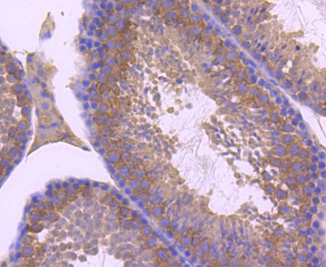Anti-ZNRF2 Antibody (2E492)