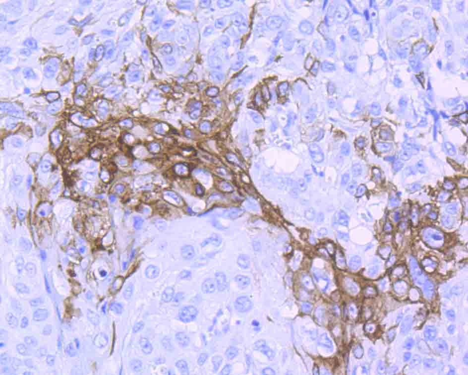 Anti-Wnt5a Antibody (2Q540)