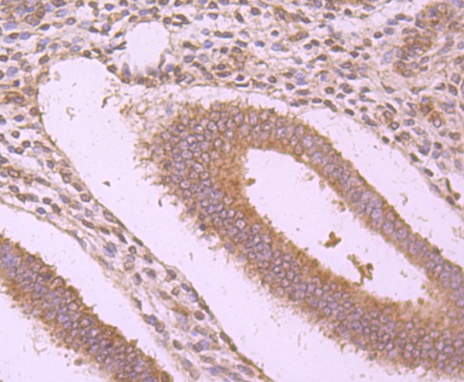 Anti-WSCD2 Antibody (7M244)