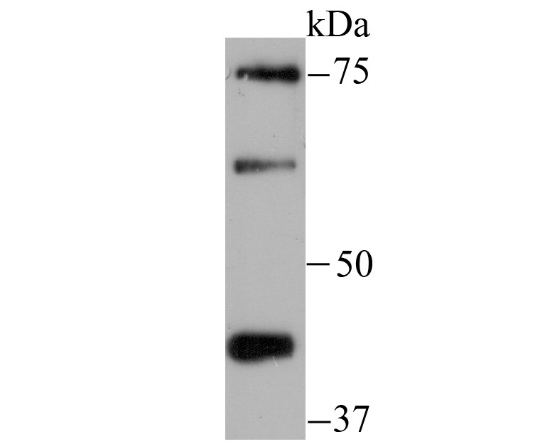 Anti-Zyxin Antibody (5W666)