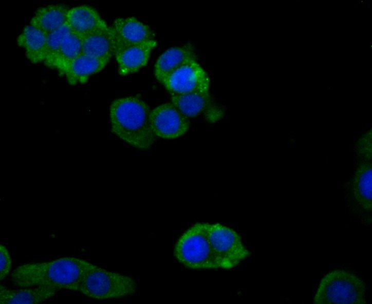 Anti-Zyxin Antibody (5W666)
