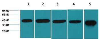 Anti-Beta-Actin Antibody (2J441)