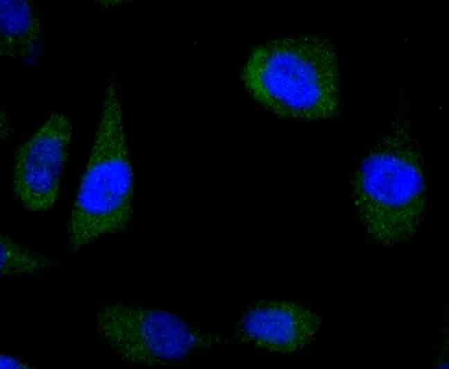 Anti-Wnt5a Antibody (2Q540)