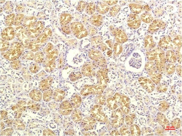 Anti-IL-8/CXCL8 Antibody (5C911)
