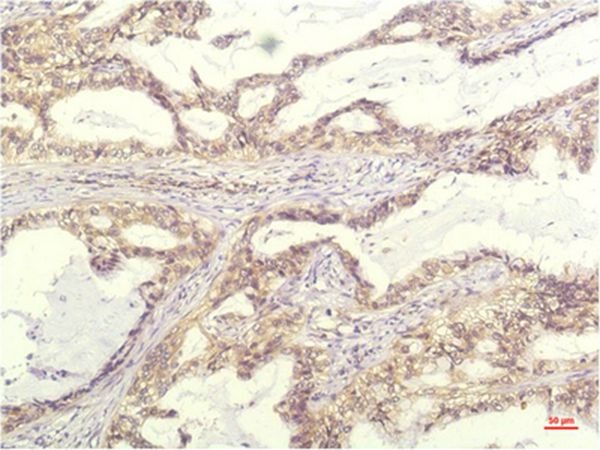 Anti-IL-8/CXCL8 Antibody (5C911)