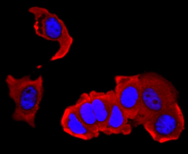 Anti-IL-4 Antibody (1H299)