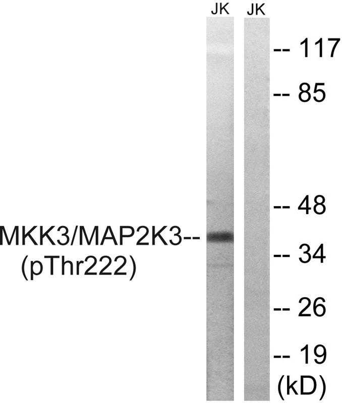 Anti-Phospho-MAP2K3 (Thr222) Polyclonal Antibody 2