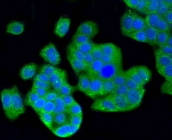 Anti-MAP1LC3A Antibody (4Q42)