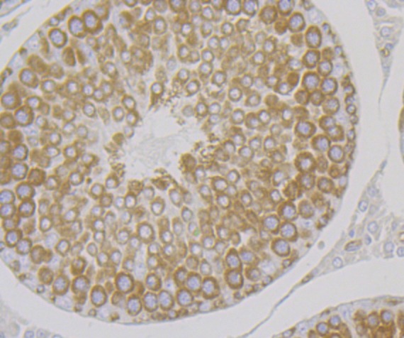 Anti-KARS Antibody (1C183)