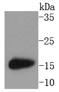 Anti-MAP1LC3A Antibody (5H585)