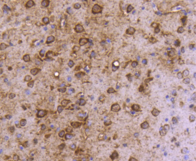 Anti-MAP1LC3A Antibody (5H585)