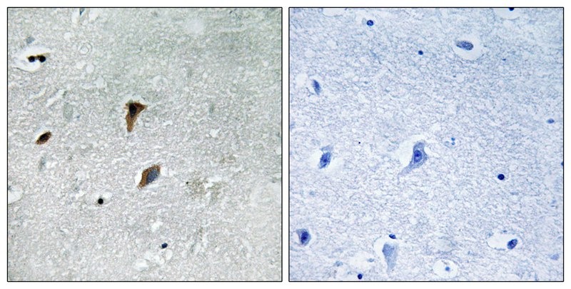 Anti-Phospho-MAP2K3 (Thr222) Polyclonal Antibody 2