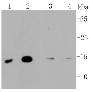 Anti-MAP1LC3A Antibody (4Q42)
