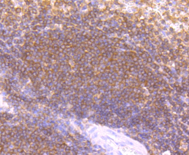 Anti-LYVE1 Antibody (3Z624)