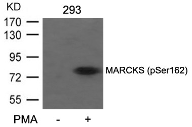 Anti-Phospho-MARCKS (Ser162) Polyclonal Antibody